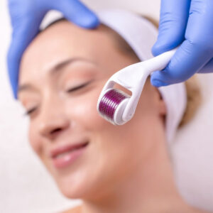 Scalico Microneedle Derma Roller – Skin Renewal & Collagen Booster
